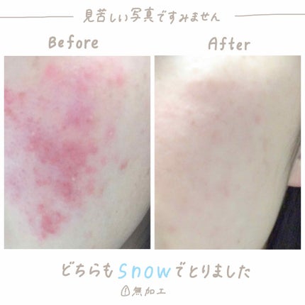 薬用しみ対策 美白化粧水/メラノCC/化粧水を使ったクチコミ(2枚目)