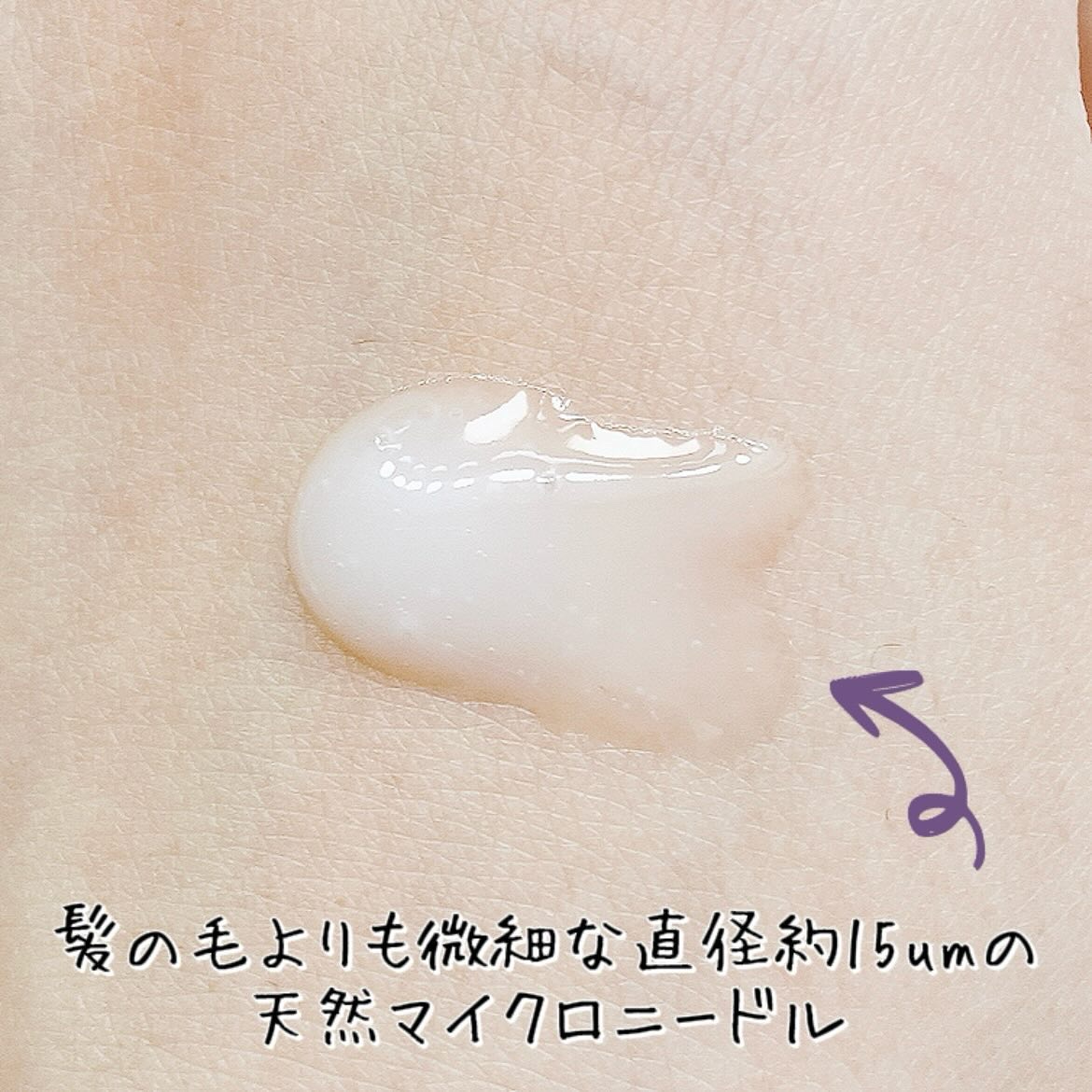 ビディ ニードルエッセンス GG/ビディ/美容液を使ったクチコミ（3枚目）