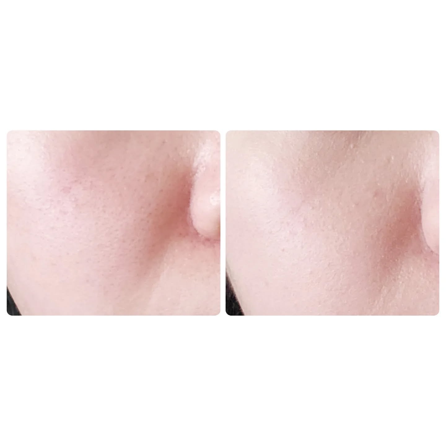 ケイト バーチャルスキンメイカー/KATE/リキッドファンデーションを使ったクチコミ（3枚目）