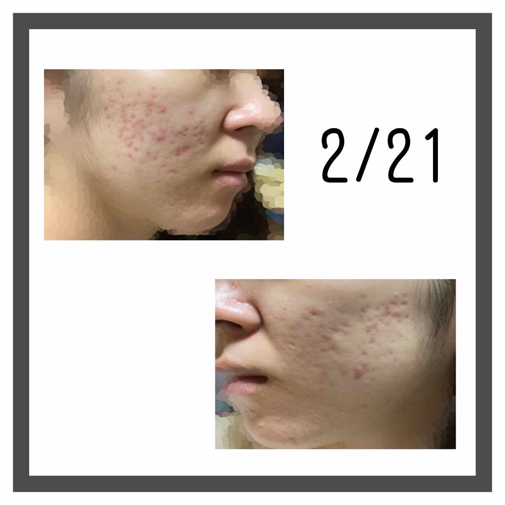 ノーセバム ミネラルパウダー/innisfree/ルースパウダーを使ったクチコミ(1枚目)