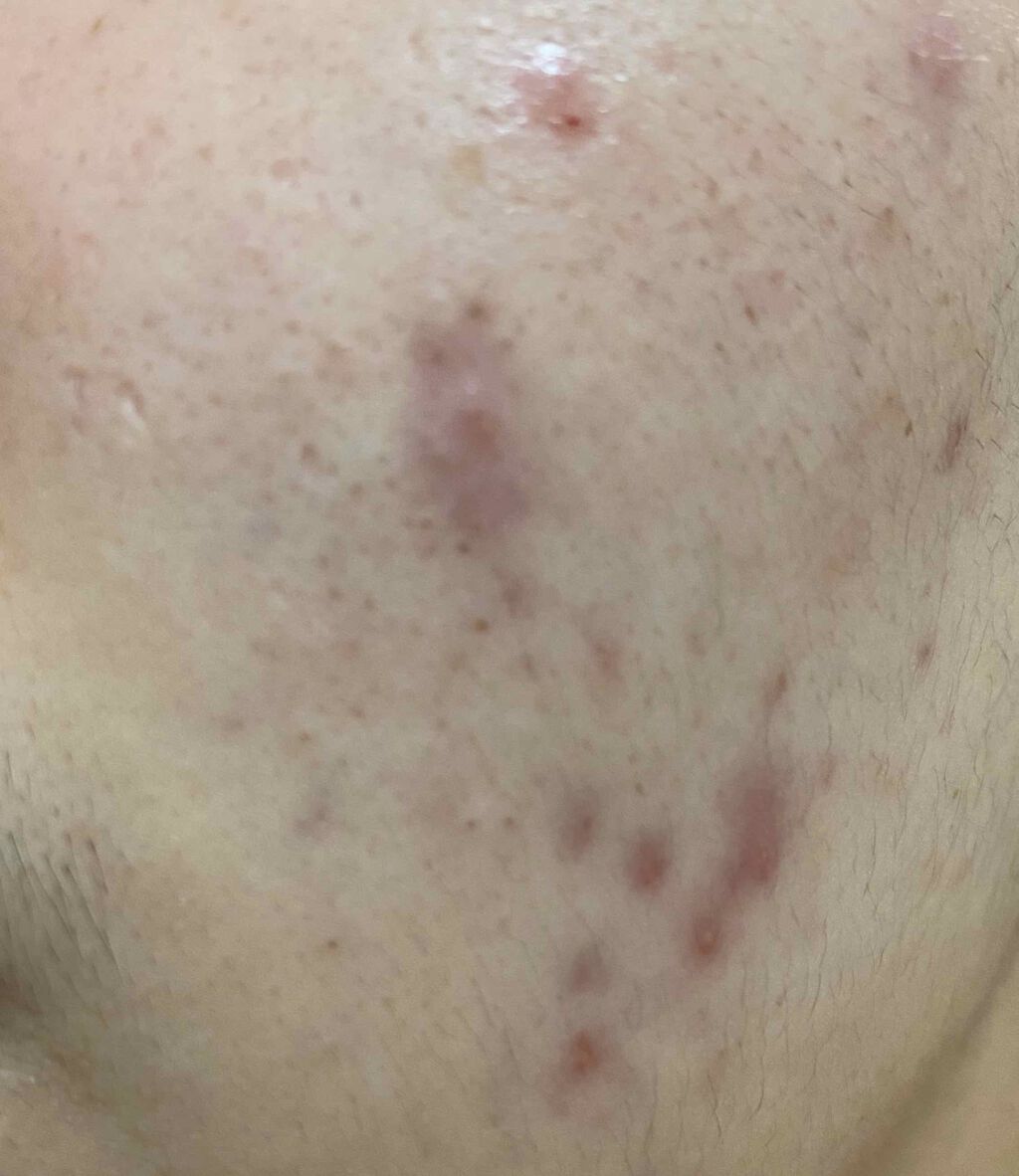 Cセラム/b.glen/美容液を使ったクチコミ（3枚目）