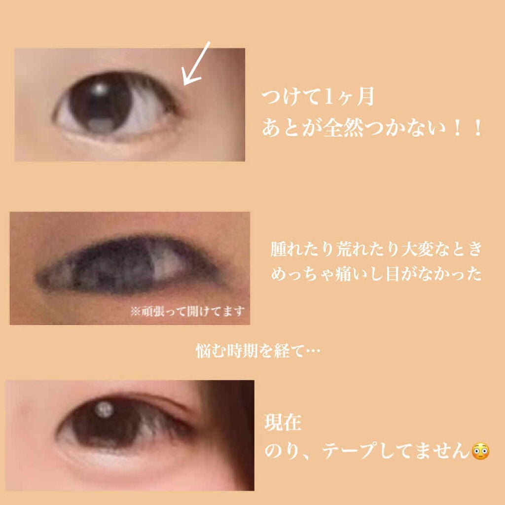 アイトーク/アイトーク/二重まぶた用アイテムを使ったクチコミ(2枚目)