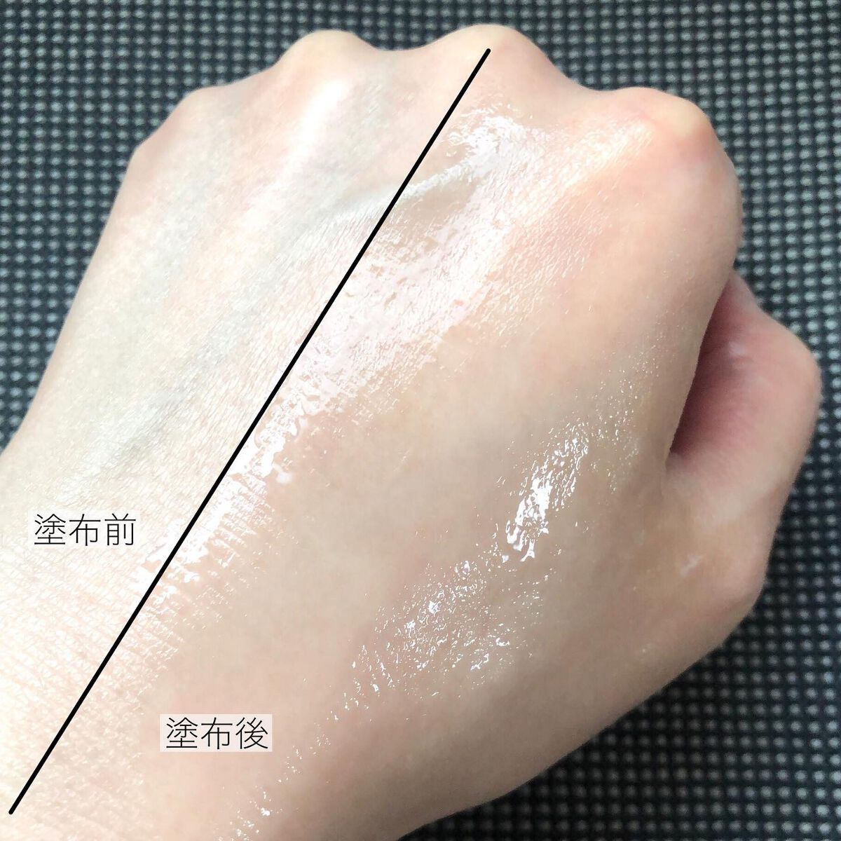 エイシカ365 ブレミッシュカーミングセラム/AESTURA/美容液を使ったクチコミ(5枚目)