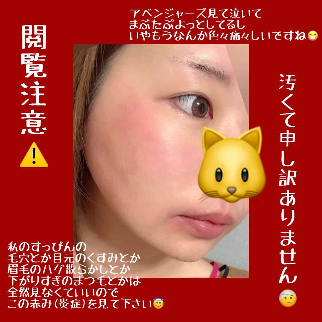 フェイスエピローラー/コジット/その他化粧小物を使ったクチコミ(3枚目)