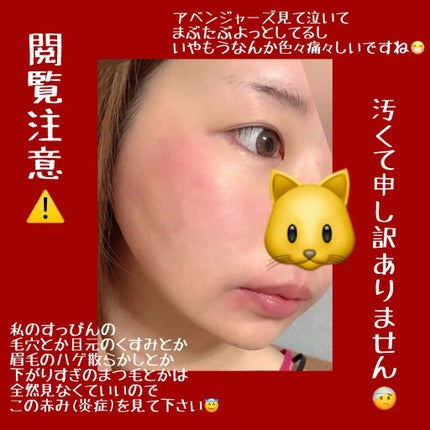 フェイスエピローラー/コジット/その他化粧小物を使ったクチコミ(3枚目)