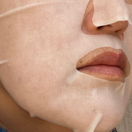 ダーマレーザースペクター VCMAX マスク/クオリティファースト/シートマスク・パックを使ったクチコミ(5枚目)