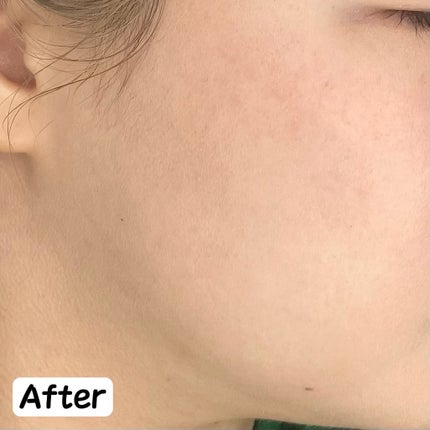 シンクロスキン セルフリフレッシング ファンデーション/SHISEIDO/リキッドファンデーションを使ったクチコミ(5枚目)