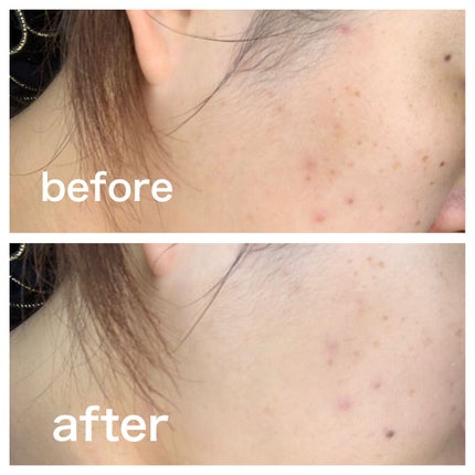 肌潤 マルチCCクリーム/米肌/CCクリームを使ったクチコミ(2枚目)