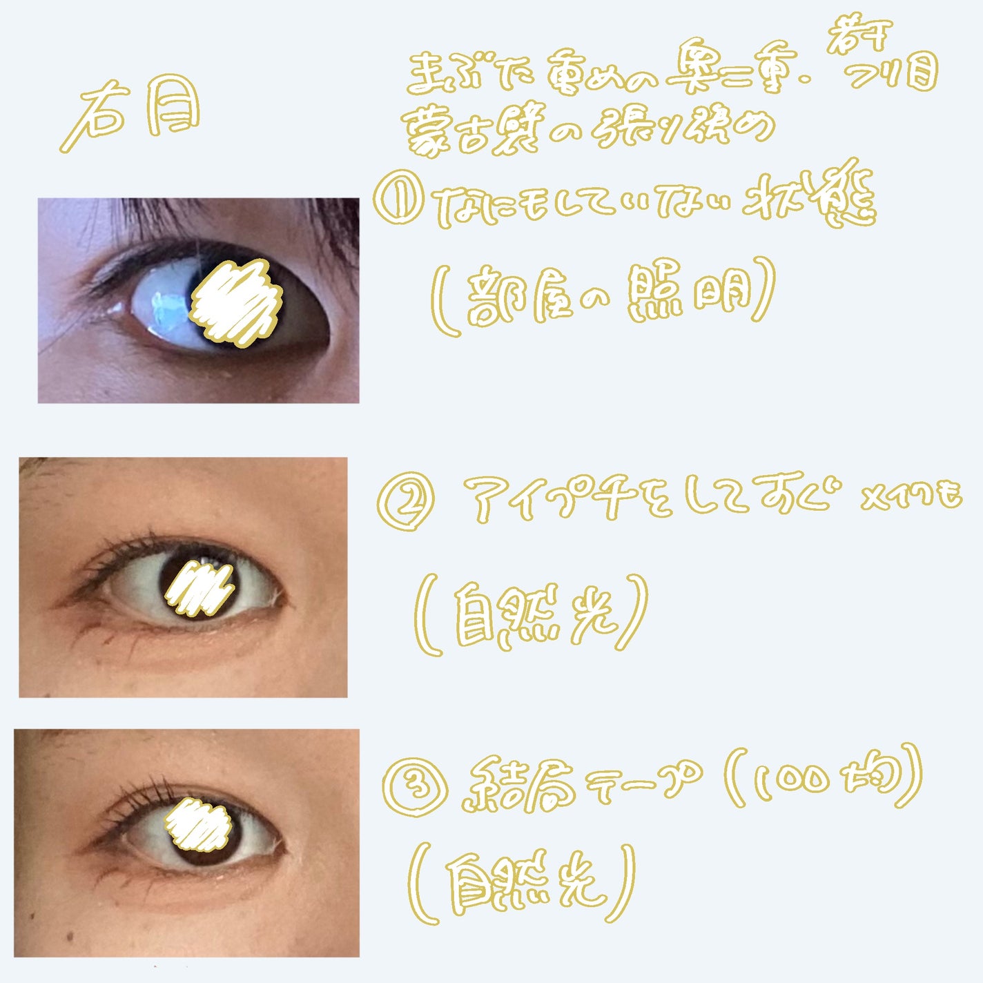 アイテープ(絆創膏タイプ、レギュラー、70枚)/DAISO/二重まぶた用アイテムを使ったクチコミ(4枚目)