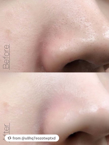 マイルドクレンジング オイル〈ブラック&スムース〉/ファンケル/オイルクレンジングを使ったクチコミ(6枚目)