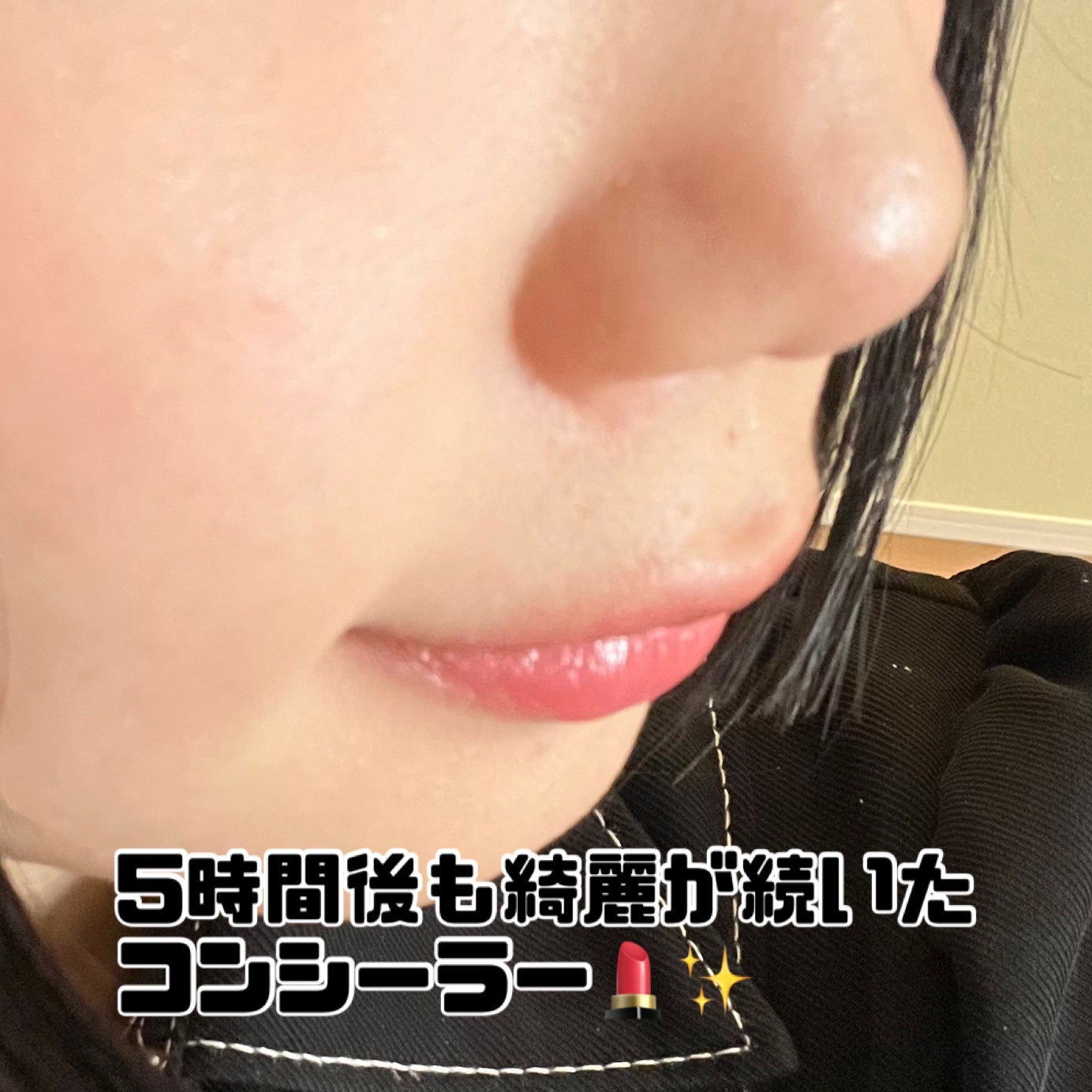 ダーマシンコンシーラー/23years old/リキッドコンシーラーを使ったクチコミ(1枚目)