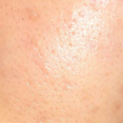 ジェルクリーム/ルナメアAC/フェイスクリームを使ったクチコミ(2枚目)