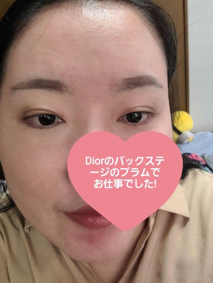 ヒルマイルドクリーム(医薬品)/健栄製薬/その他を使ったクチコミ(5枚目)