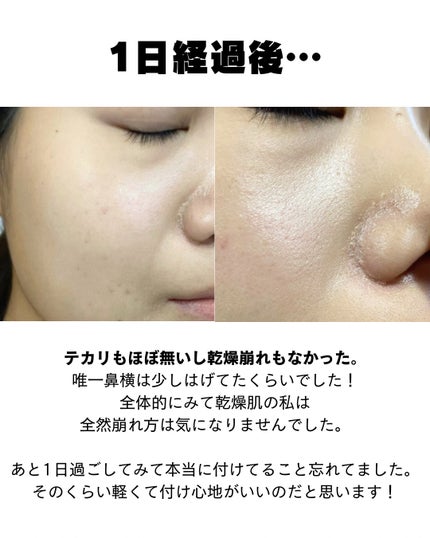 スキンセラムファンデーション/qiolo/リキッドファンデーションを使ったクチコミ(5枚目)