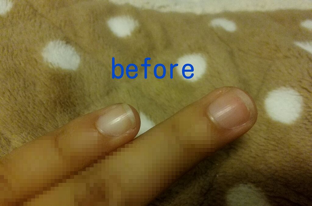 AC キューティクルオイル/AC MAKEUP/ネイルオイル・トリートメントを使ったクチコミ(2枚目)