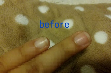 AC キューティクルオイル/AC MAKEUP/ネイルオイル・トリートメントを使ったクチコミ(2枚目)