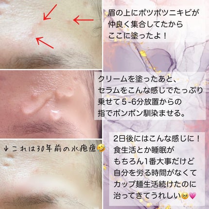 エーキュアトラブルカーミングセラム/obsero/美容液を使ったクチコミ(3枚目)