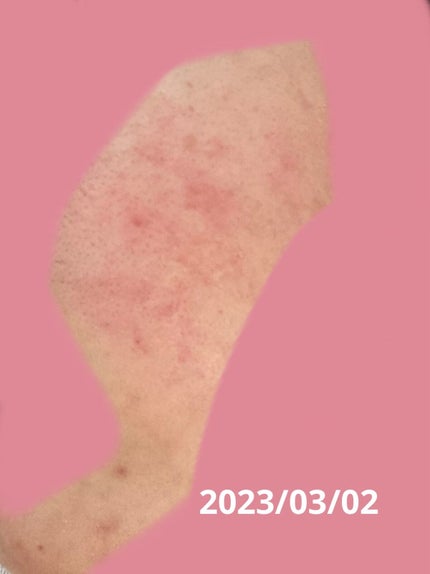 薬用しみ対策 美白化粧水/メラノCC/化粧水を使ったクチコミ(2枚目)