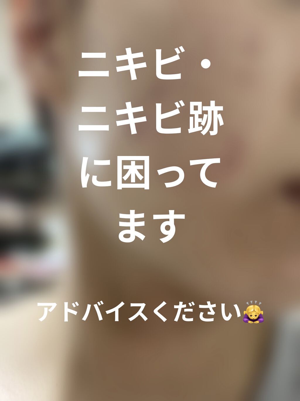 ニキビあとケアジェル/アットノン/その他スキンケアを使ったクチコミ（1枚目）