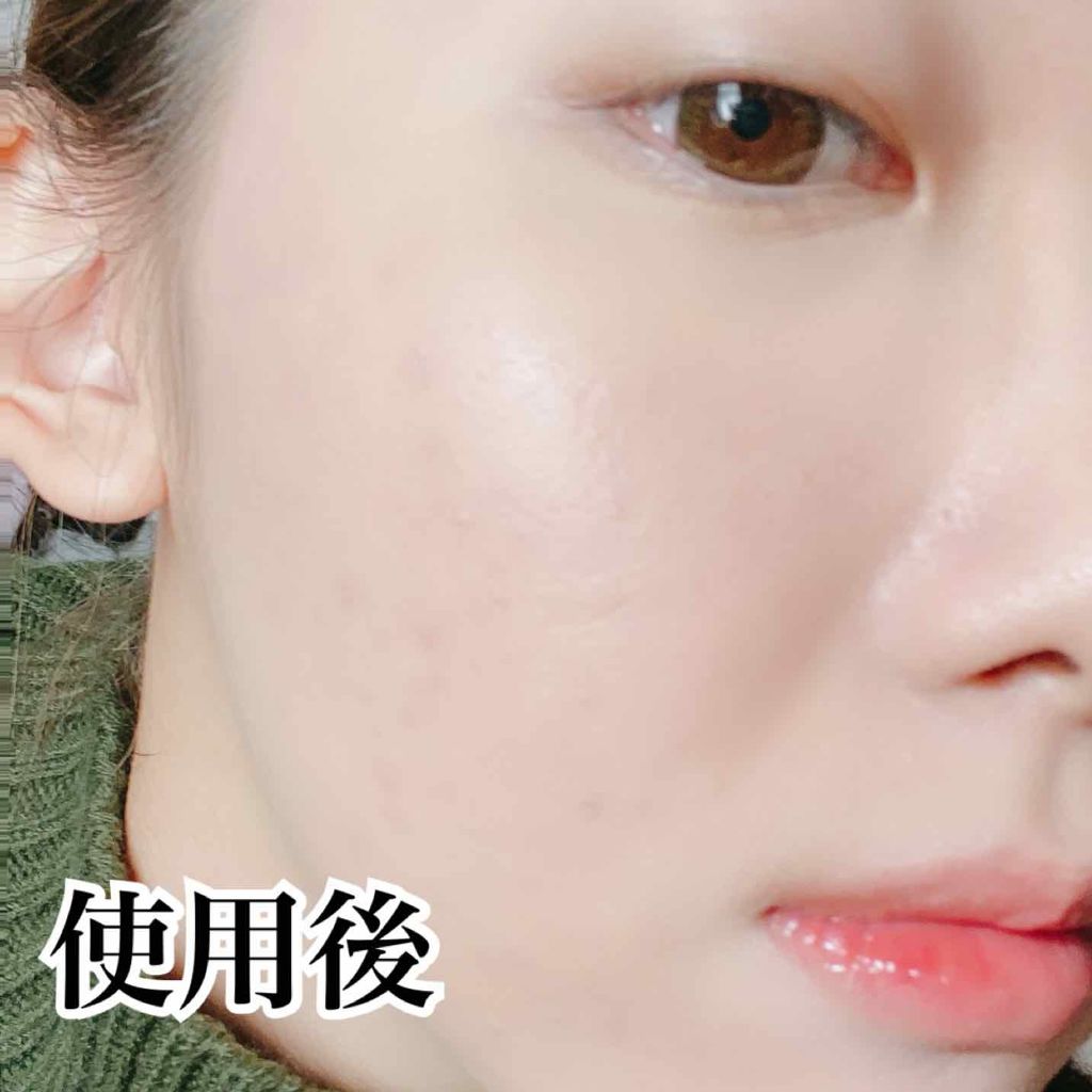 【旧】ディオールスキン フォーエヴァー フルイド グロウ/Dior/リキッドファンデーションを使ったクチコミ(3枚目)