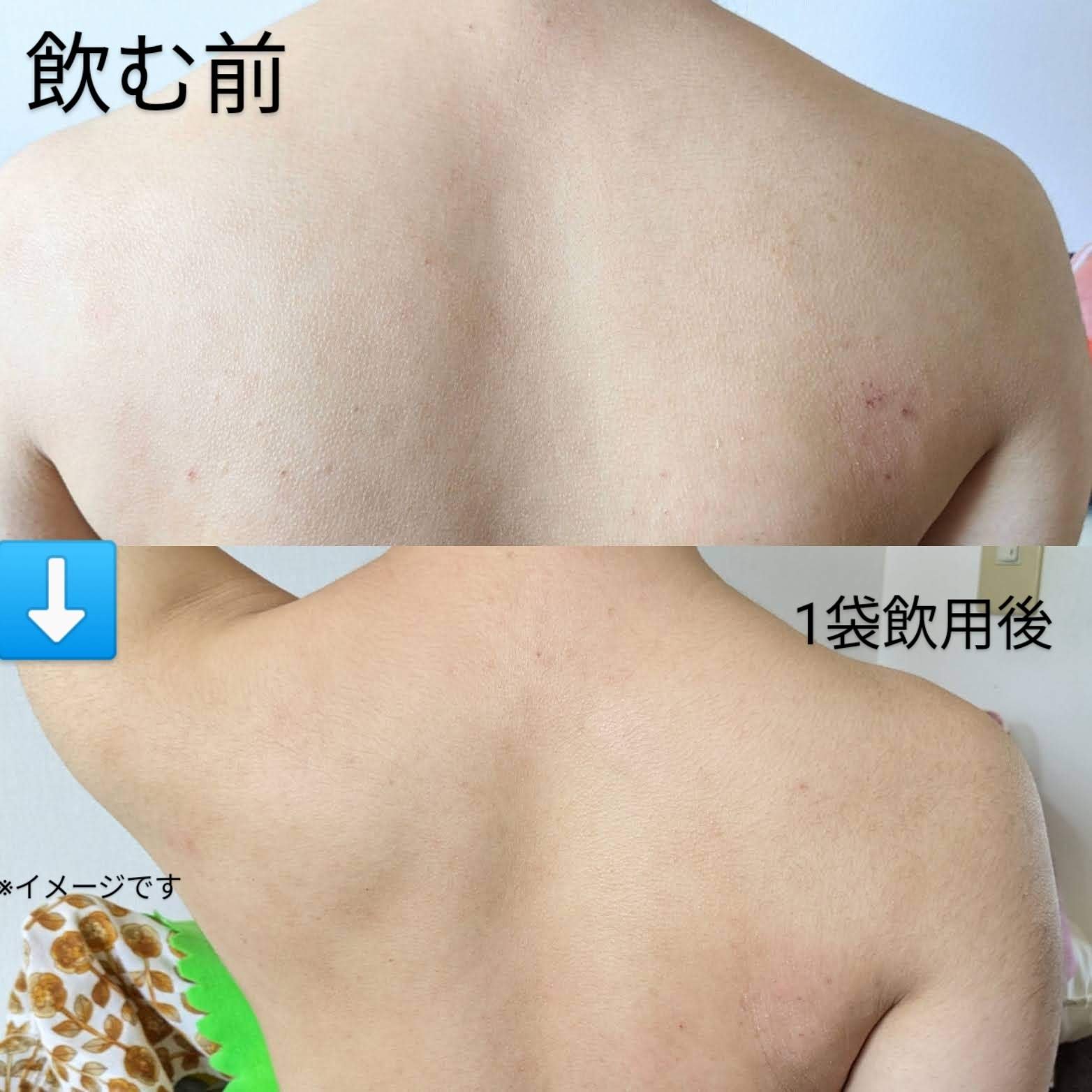 Hadaral 十味敗毒湯錠(医薬品)/大峰堂/その他を使ったクチコミ（2枚目）