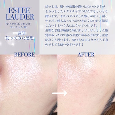 マイクロ エッセンス ローション BF/ESTEE LAUDER/化粧水を使ったクチコミ（2枚目）