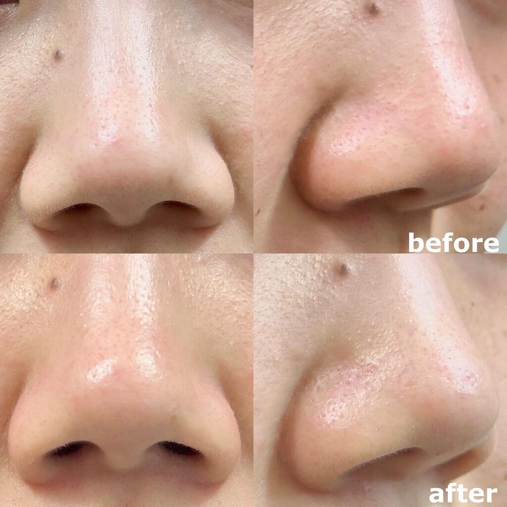 ソフィーナ iP ポア クリアリング ジェル ウォッシュ/SOFINA iP/その他洗顔料を使ったクチコミ(3枚目)