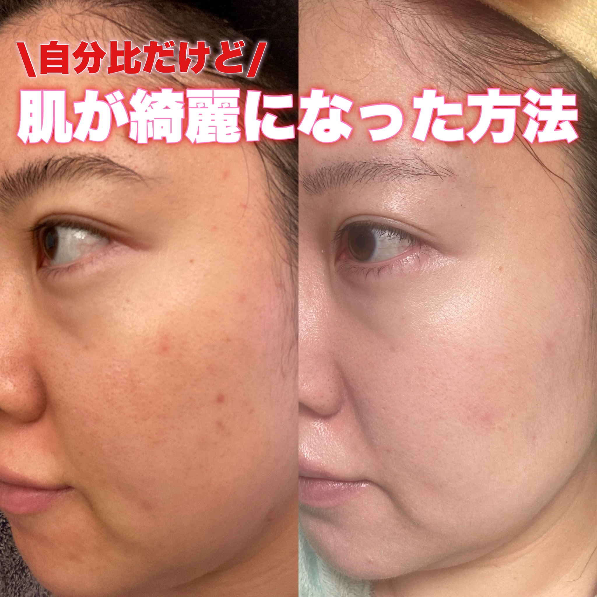 トリートメント クレンジング ミルク/COVERMARK/ミルククレンジングを使ったクチコミ（1枚目）