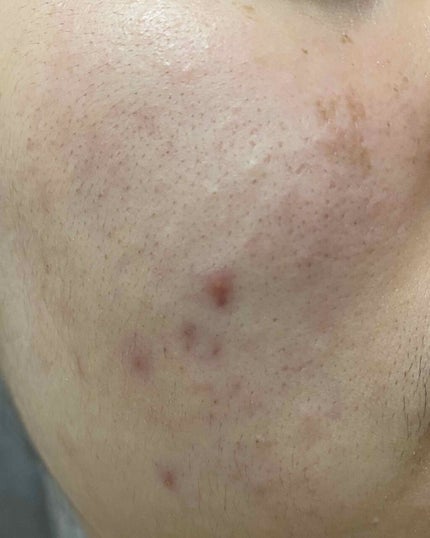 敏感肌用薬用美白美容液/無印良品/美容液を使ったクチコミ(2枚目)