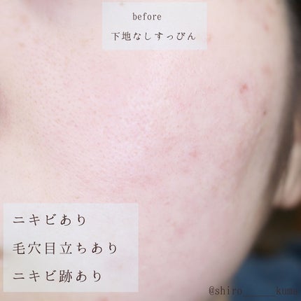 ピンクティーツリーカバークッション/APLIN/クッションファンデーションを使ったクチコミ(5枚目)