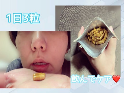 NATUDEO/ナチュビブレ/ボディサプリメントを使ったクチコミ(2枚目)