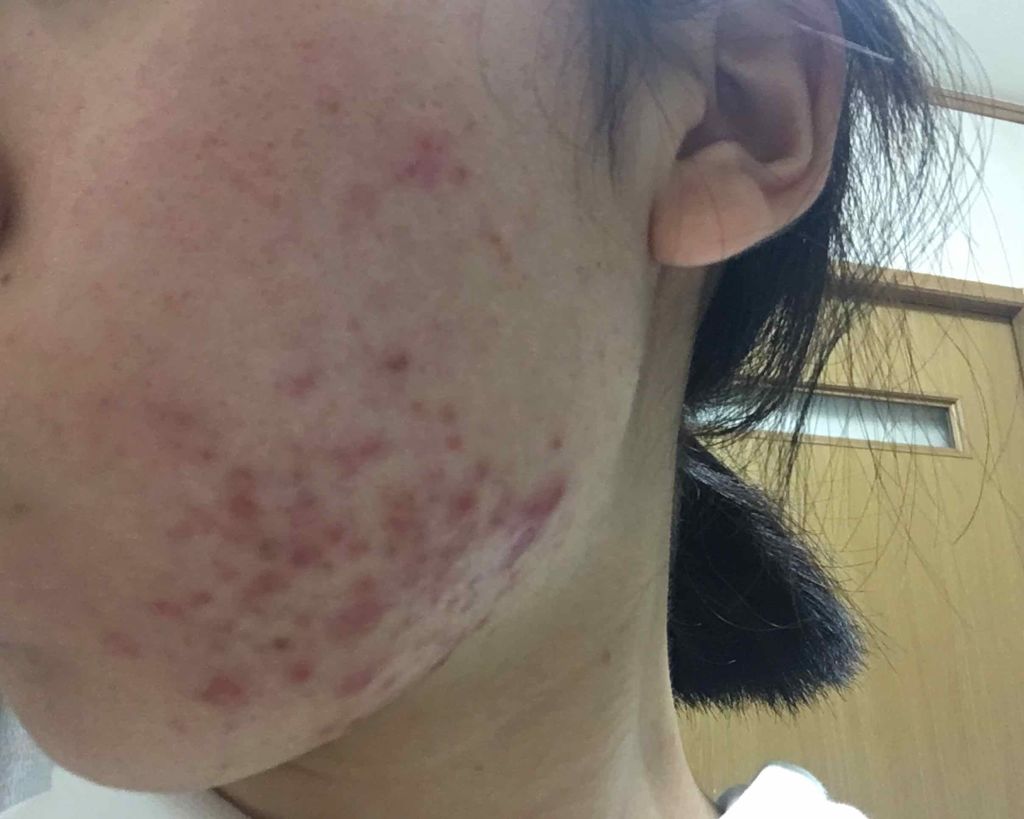 クリアトライアルセット M（しっとりタイプ）/オルビス/トライアルキットを使ったクチコミ（3枚目）