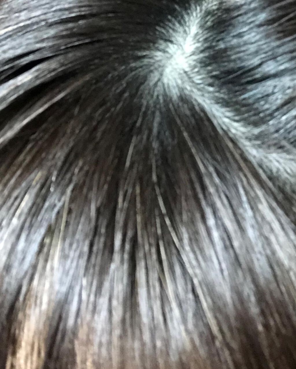 薬用RJ地肌ケアエッセンス/アピセラピーコスメティクス/頭皮ローションを使ったクチコミ(8枚目)