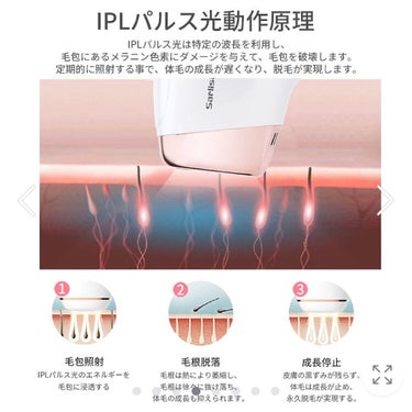 光脱毛器 VIO/Sarlisi/家庭用脱毛器を使ったクチコミ（3枚目）