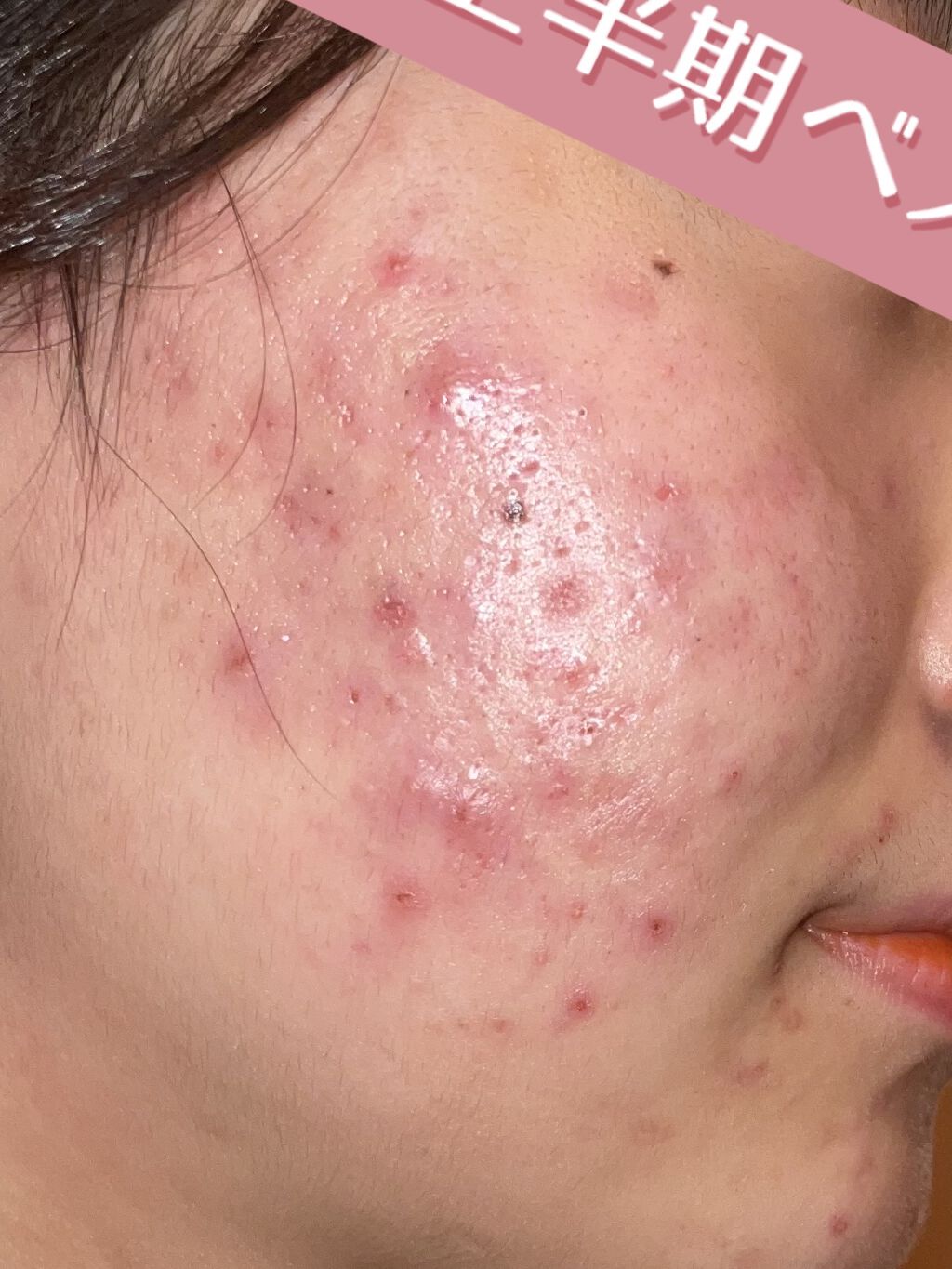 CICA カプセルマスク/VT/洗い流すパック・マスクを使ったクチコミ（2枚目）