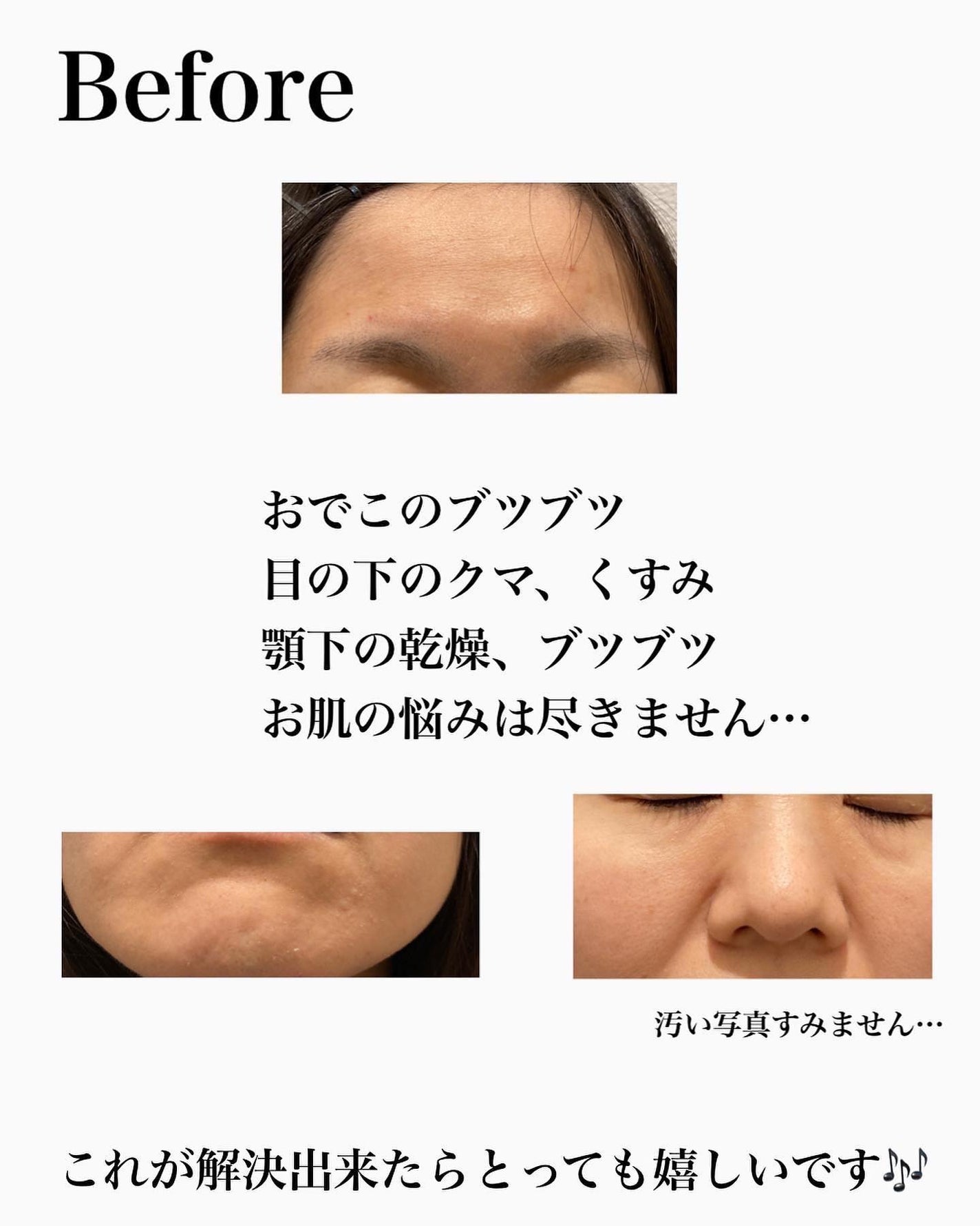 Kooスキンローション/Koo/化粧水を使ったクチコミ(4枚目)