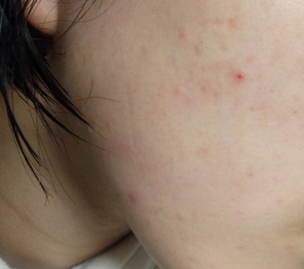 りん on LIPS 「皆さん!!助けてください!どうも、りん🌼🍨です。久しぶりの投稿..」(4枚目)