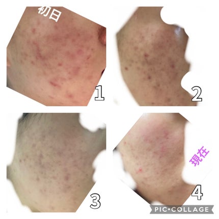 ハトムギ浸透乳液(ナチュリエ スキンコンディショニングミルク)/ナチュリエ/乳液を使ったクチコミ(4枚目)