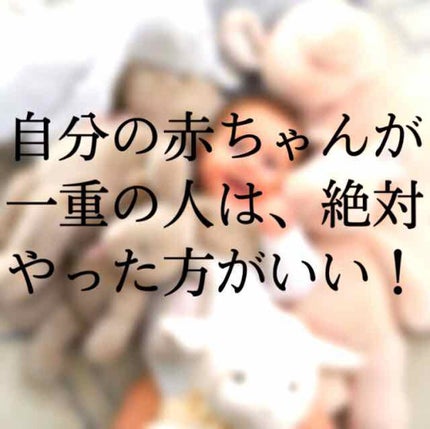 アイビューティー フィクサー WP/アストレア ヴィルゴ/二重まぶた用アイテムを使ったクチコミ(1枚目)