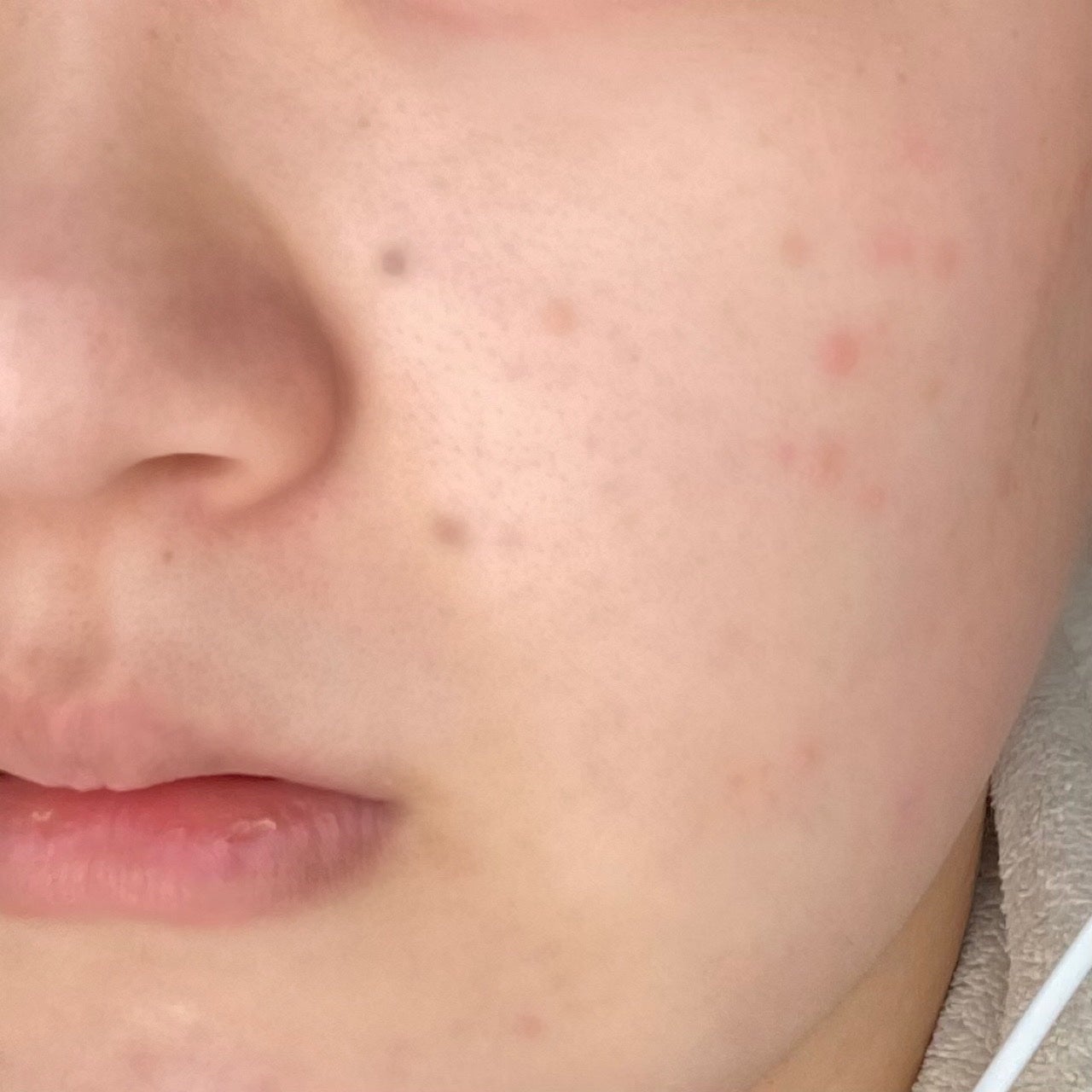 ラディアンスフィットセラムファンデーション/TFIT/リキッドファンデーションを使ったクチコミ(8枚目)