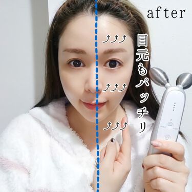 2022発売 美顔器 メディキューブAGE-R - 美容機器