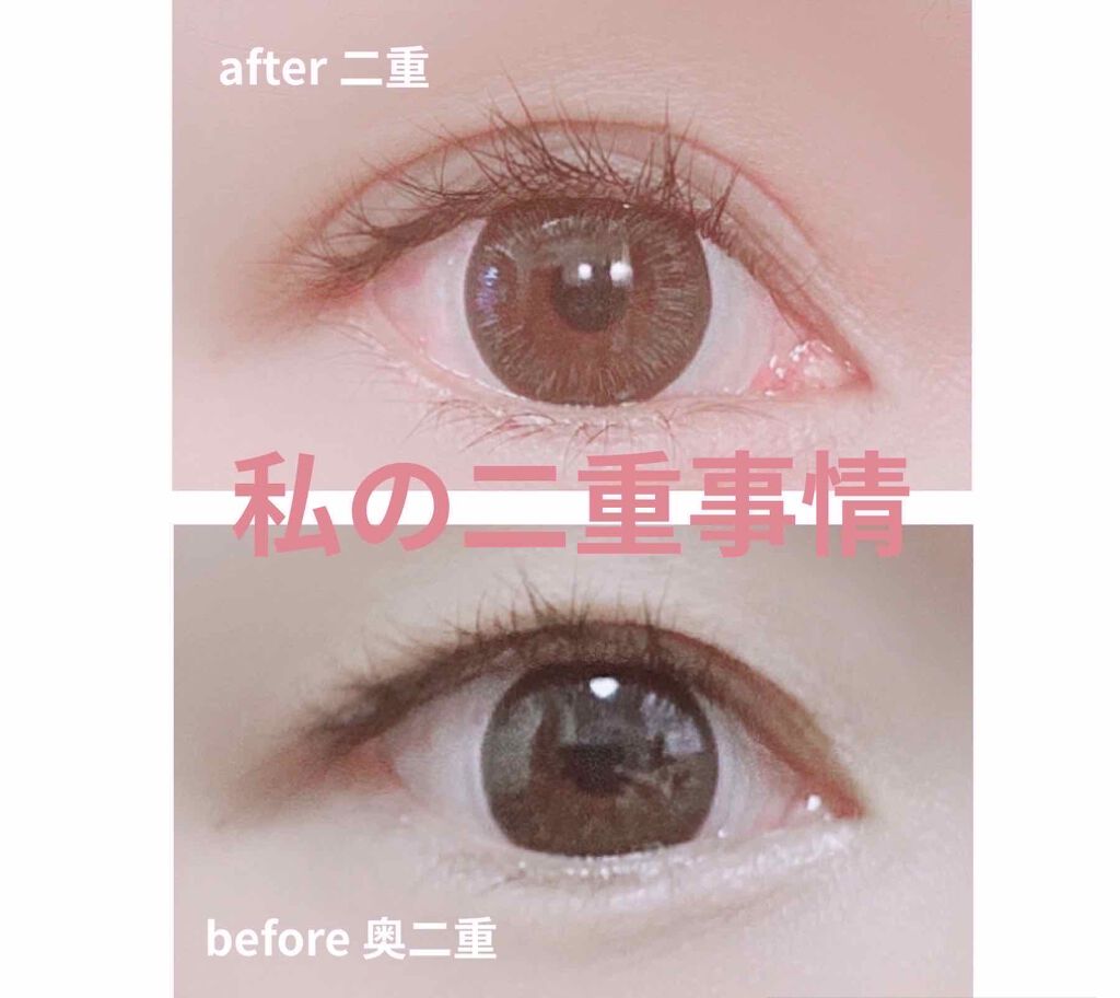 プロアイフェクトEX/プロアイフェクトEX/二重まぶた用アイテムを使ったクチコミ（1枚目）