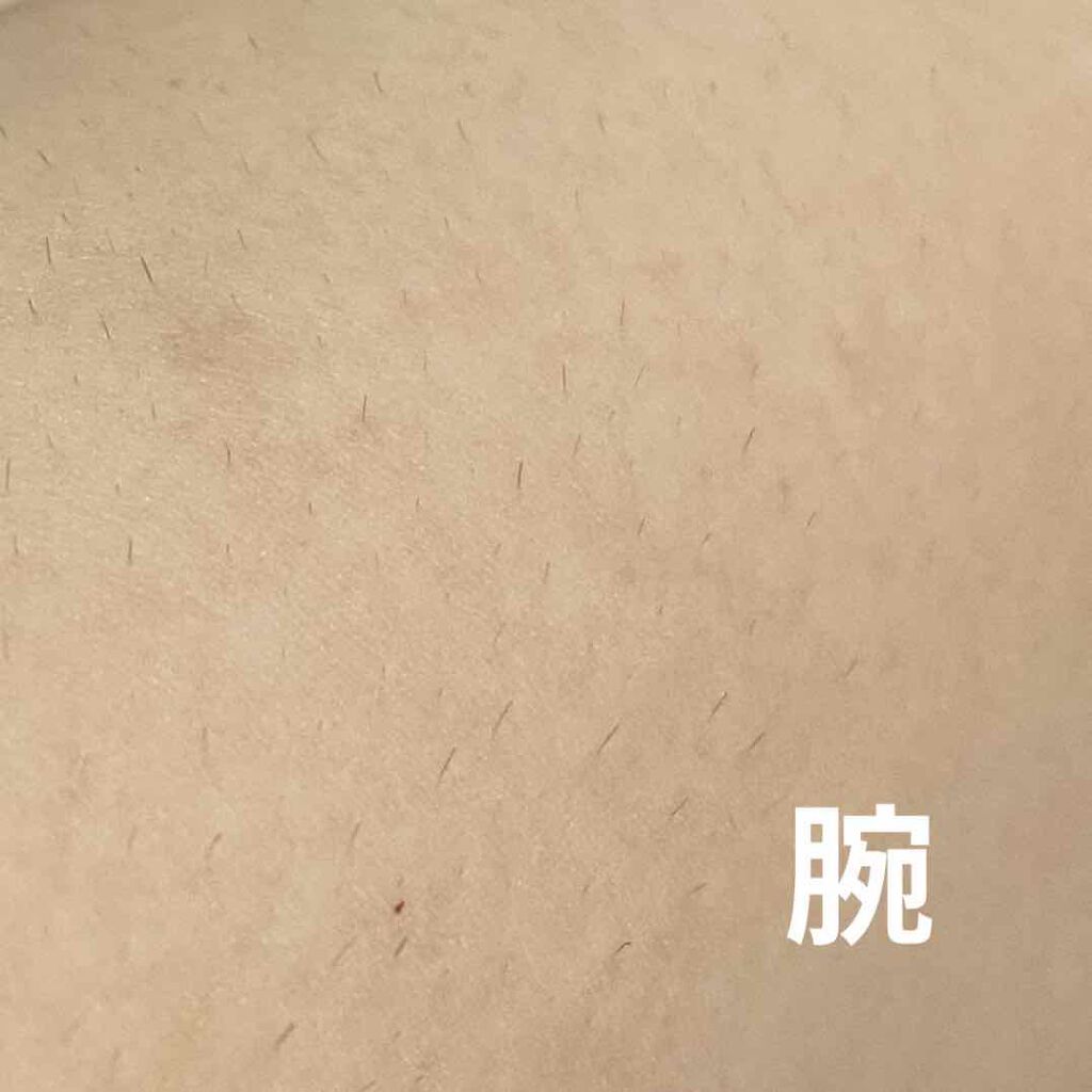 ブラウンシルクエキスパート (光美容器)/ブラウン/家庭用脱毛器を使ったクチコミ(3枚目)