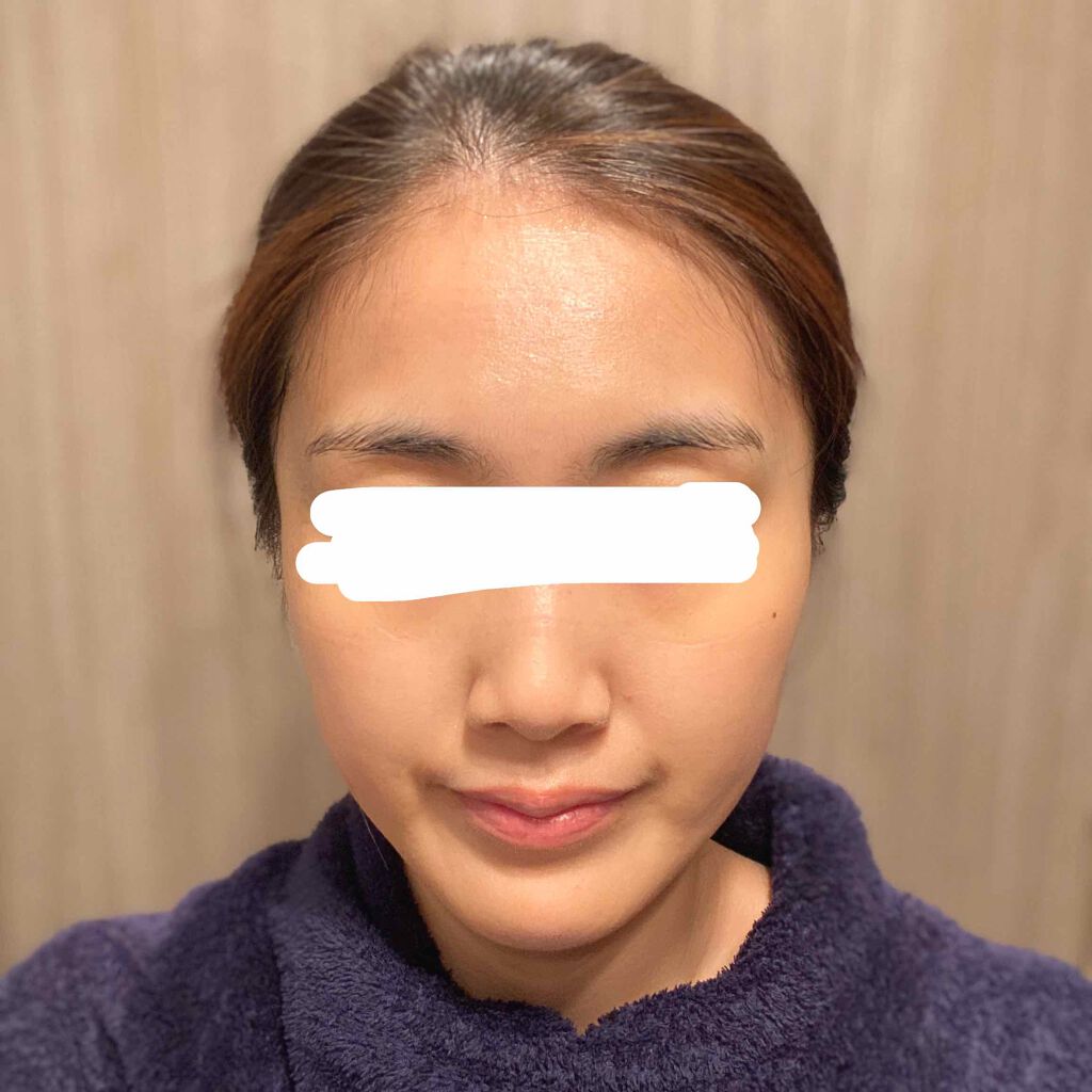 I.P.IライトマックスAPマスクEX/MEDIHEAL/シートマスク・パックを使ったクチコミ（2枚目）