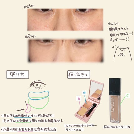 【旧】ディオールスキン フォーエヴァー スキン コレクト コンシーラー/Dior/リキッドコンシーラーを使ったクチコミ(1枚目)