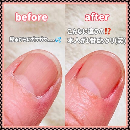 オイルインキューティクルプッシャーペン/ビューティーワールド/ネイル用品を使ったクチコミ(2枚目)