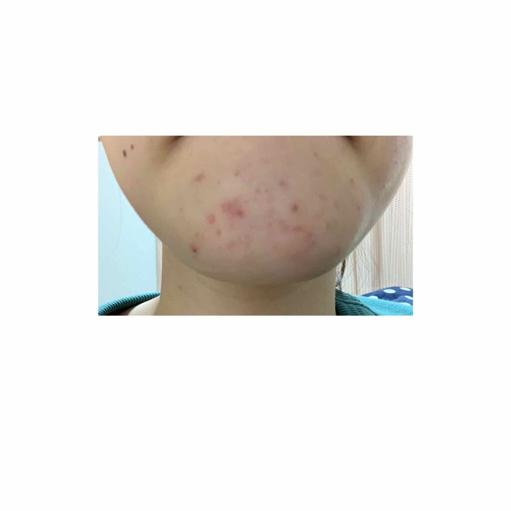 N10+Z1フェイスセラム /The Ordinary/美容液を使ったクチコミ（2枚目）