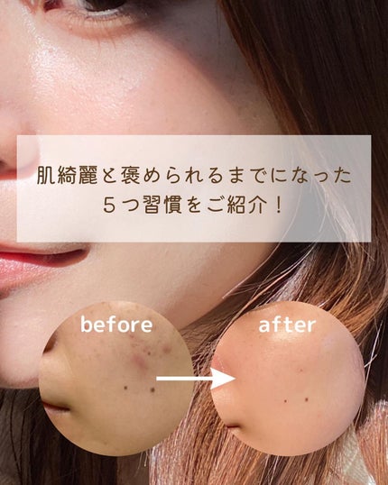 マデカクリーム/センテリアン24/フェイスクリームを使ったクチコミ(2枚目)