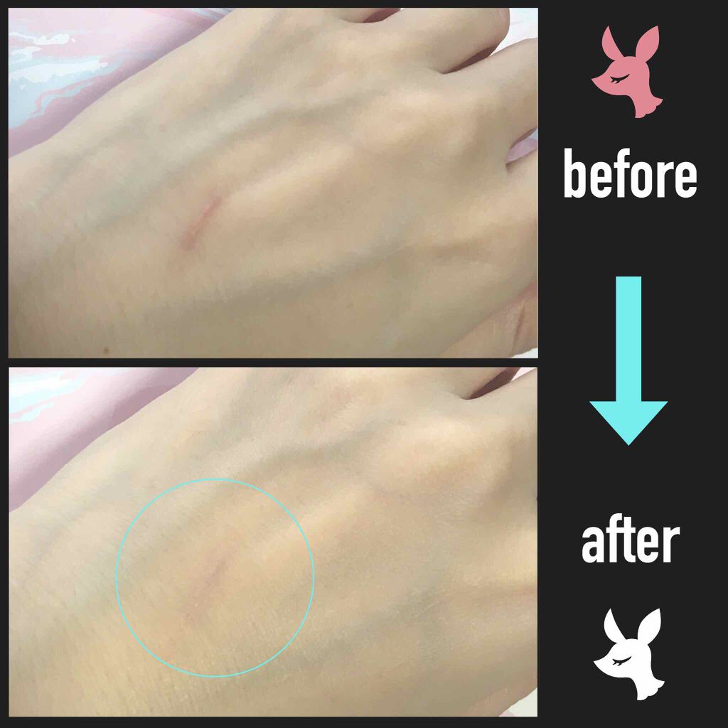 ラディアントクリーミーコンシーラー/NARS/リキッドコンシーラーを使ったクチコミ（2枚目）