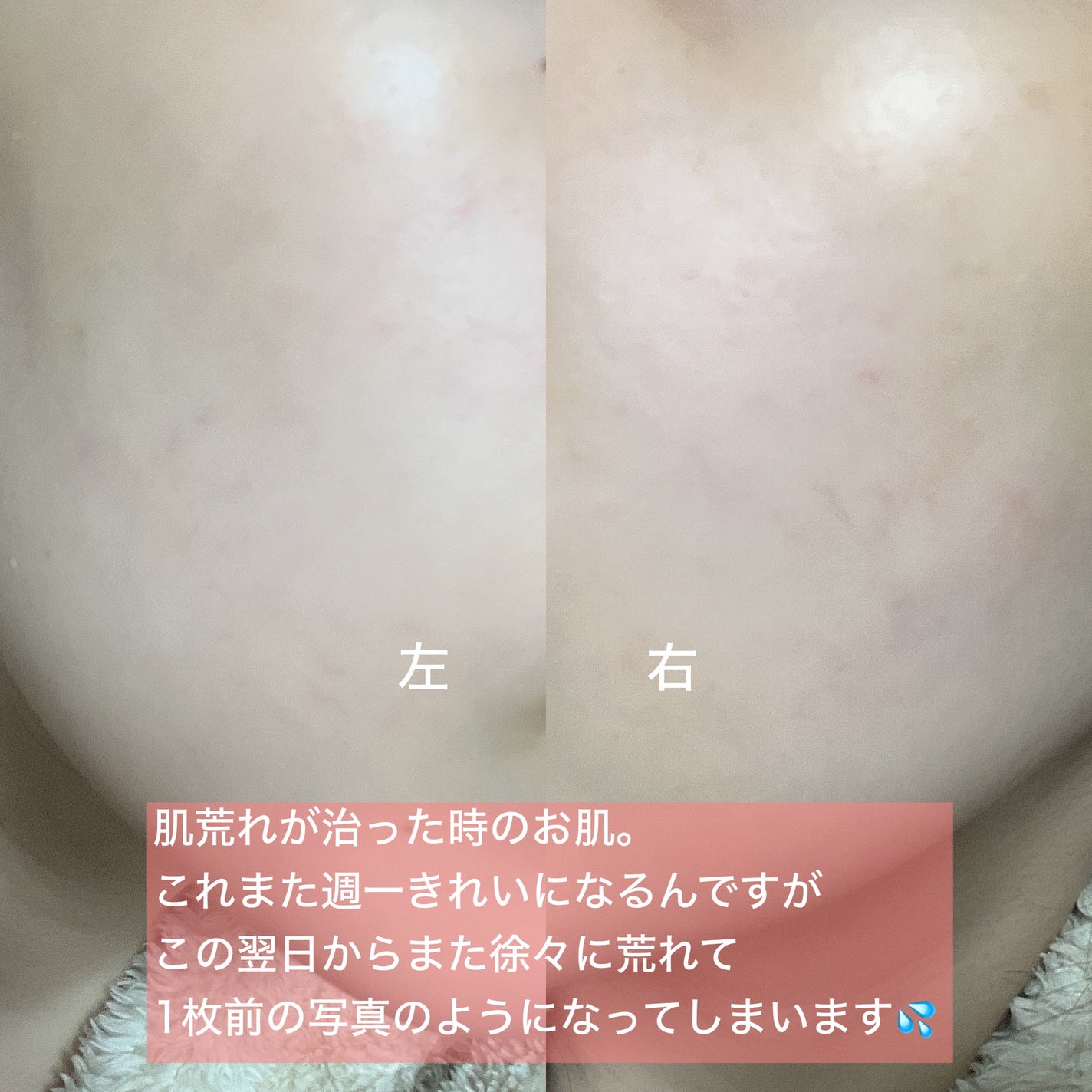 クリアフル トライアルセット M/オルビス/トライアルキットを使ったクチコミ(5枚目)